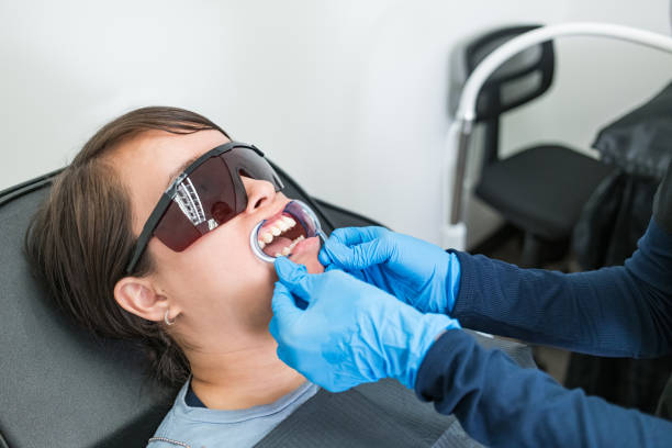 Best Chipped Tooth Repair Near Me  in Honeoye Falls, NY