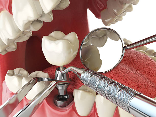 Best Knocked-Out Tooth Emergency  in Honeoye Falls, NY